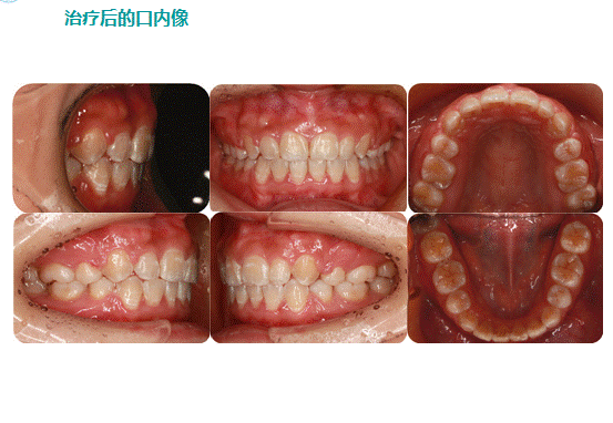 校醫院開展口腔正畸業務介紹